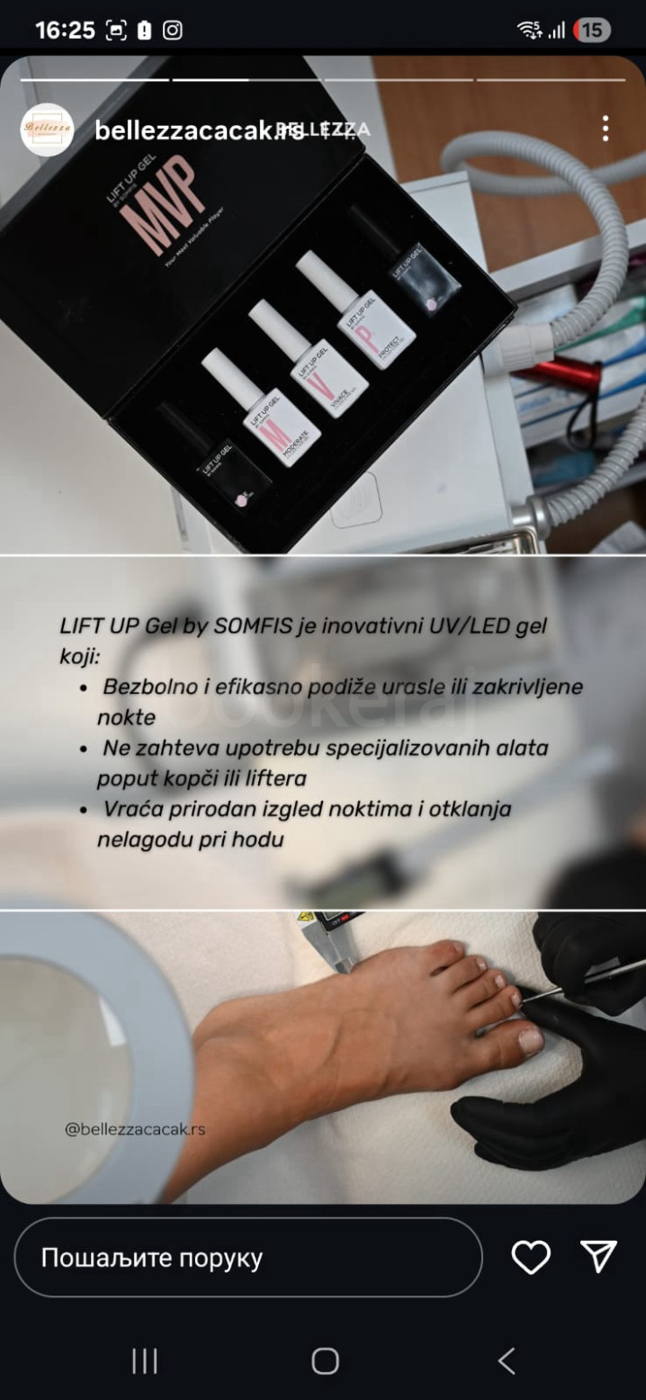 Detalji usluge